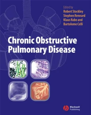 Chronic Obstructive Pulmonary Disease: A Practical Guide to Management
