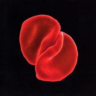 Scratch My Back (Super-Jewel-Case)