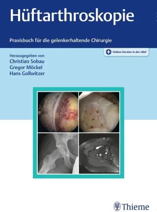Hüftarthroskopie und gelenkerhaltende Chirurgie der Hüfte