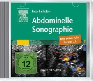 Abdominelle Sonographie: Interaktiver Atlas Version 2.0 [CD-ROM] [1999] Banholzer Peter