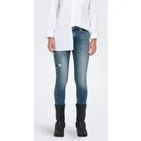 ONLY Skinny-fit-Jeans ONLBLUSH MID SKIN ANK RW DNM REA593 NOOS