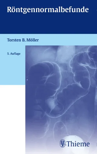 Röntgennormalbefunde [Broschiert] [2015] Möller Torsten Bert