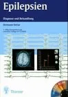 Epilepsien. Diagnose und Behandlung