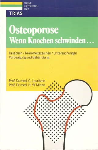 Osteoporose Wenn Knochen schwinden . . .