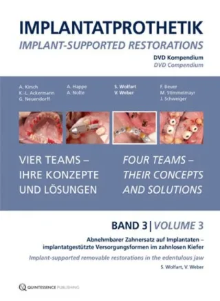 DVD-Kompendium Implantatprothetik Band 3